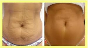 EXPERIENCIA EN BELLEZA Avisos gratis en Chile en Santiago |  YESOTERAPIA MASAJES $109.000 X 10 ses. PERMANENTE DE PESTA&Ntilde;AS + TINTE $8., MASAJES.ONDAS RUSAS.DRENAJE LINFATICO.RADIO FRECUENCIA.LIFTING SIN CIRUGIA