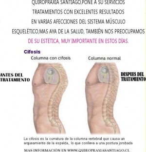 carlos Avisos gratis en Chile en Santiago |  quiropr&aacute;ctico en santiago, masajes