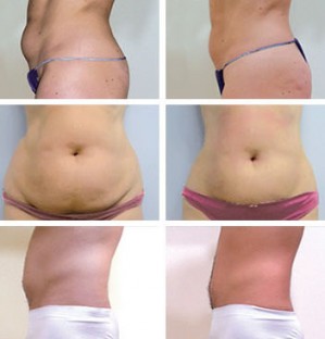 carolina riquelme Avisos gratis en Chile en La Cisterna |  masajes, a domicilio