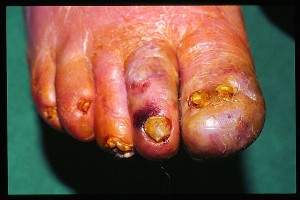 yamira munizaga olivares Avisos gratis en Chile en Copiap&oacute; |  podologa area cardio vascular, servicio de salud de tierra amarilla y copiapo (atenciones a deabetico y ad