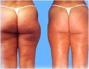 Claudia Gallo Avisos gratis en Chile en Providencia |  Masaje Reductivo,drenaje post operatorio, Medicina ayurveda,biotipos,dietas